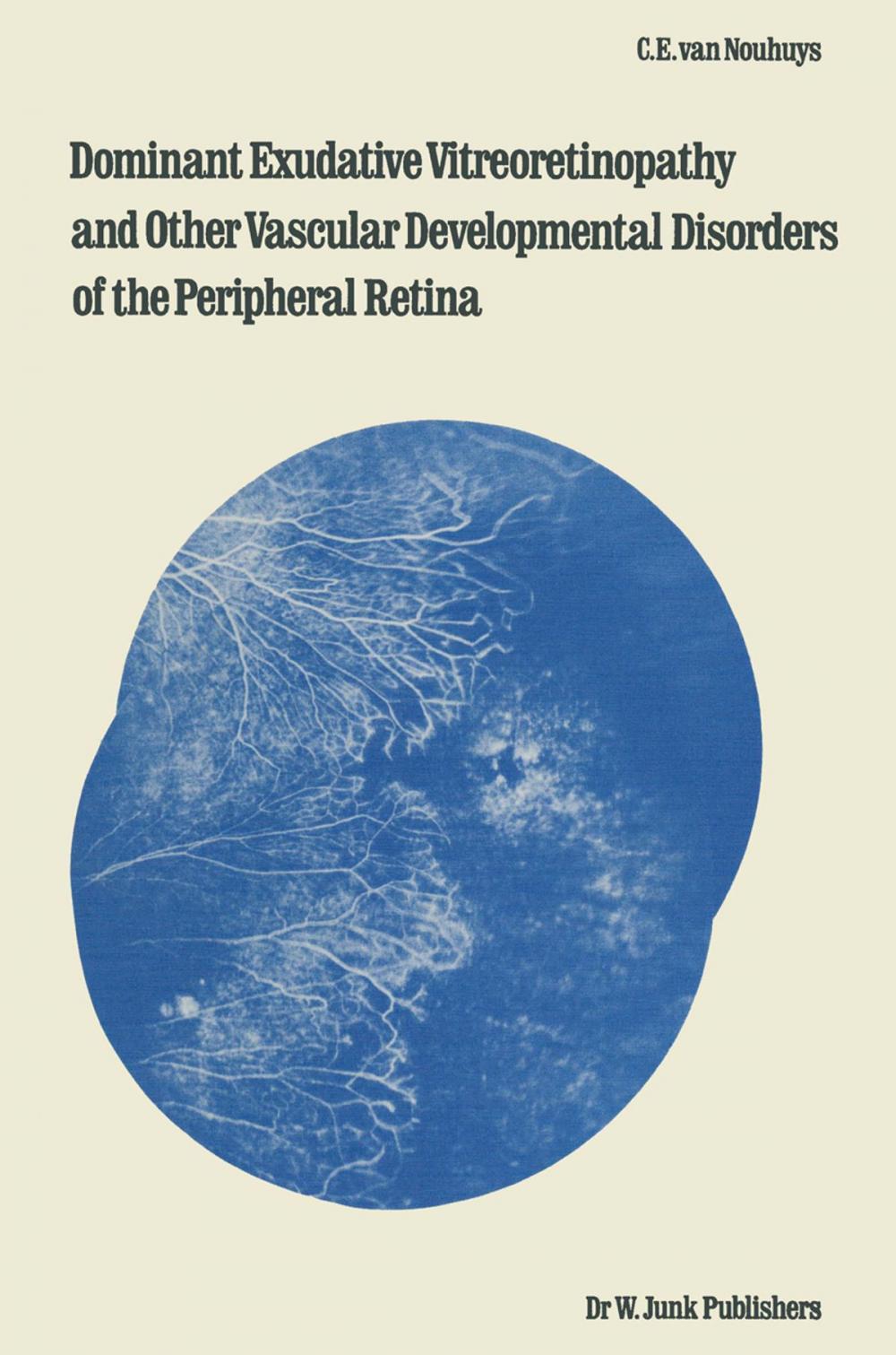 Big bigCover of Dominant Exudative Vitreoretinopathy and other Vascular Developmental Disorders of the Peripheral Retina