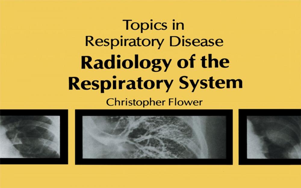 Big bigCover of Radiology of the Respiratory System