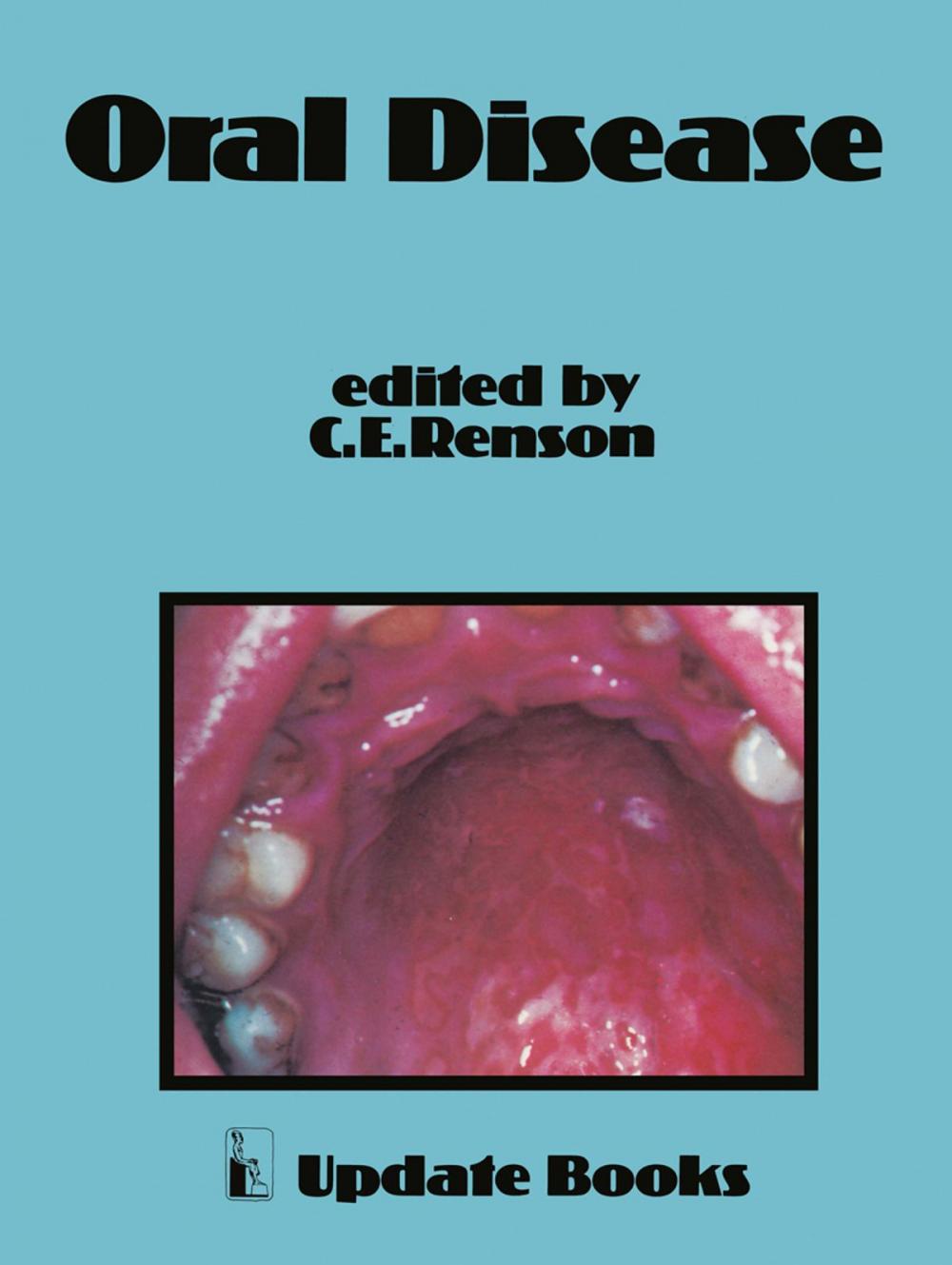 Big bigCover of Oral Disease