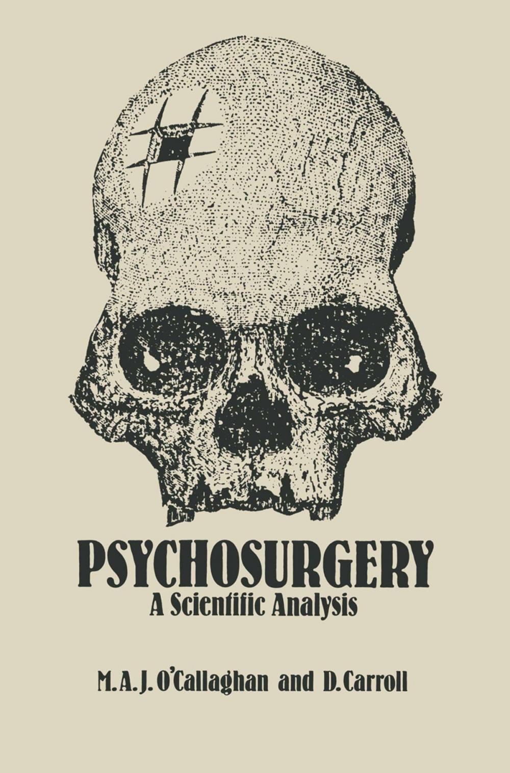 Big bigCover of Psychosurgery