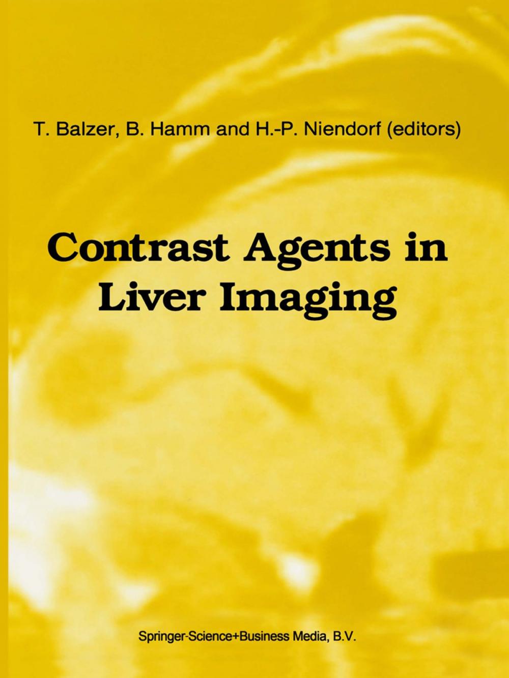 Big bigCover of Contrast Agents in Liver Imaging