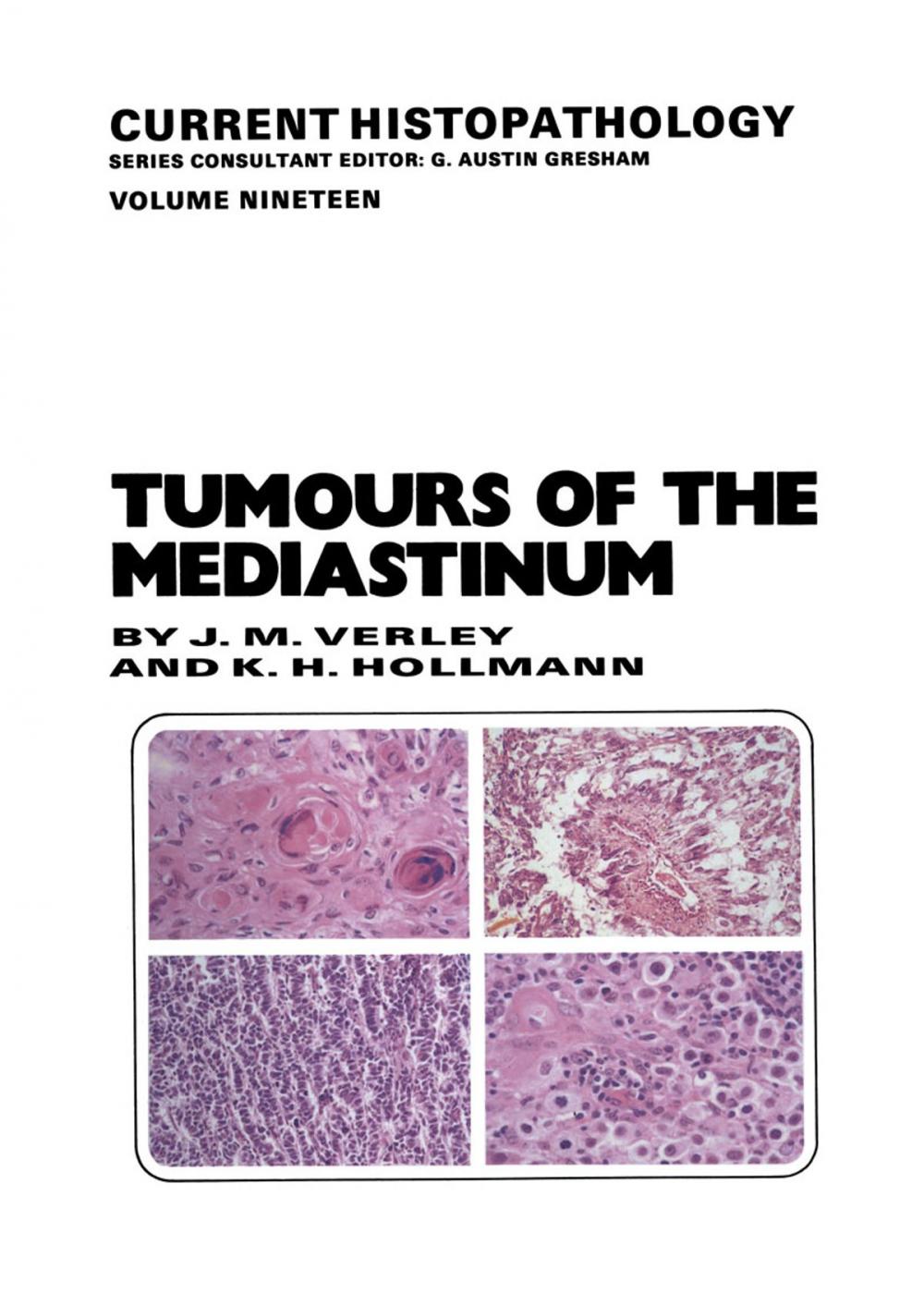 Big bigCover of Tumours of the Mediastinum