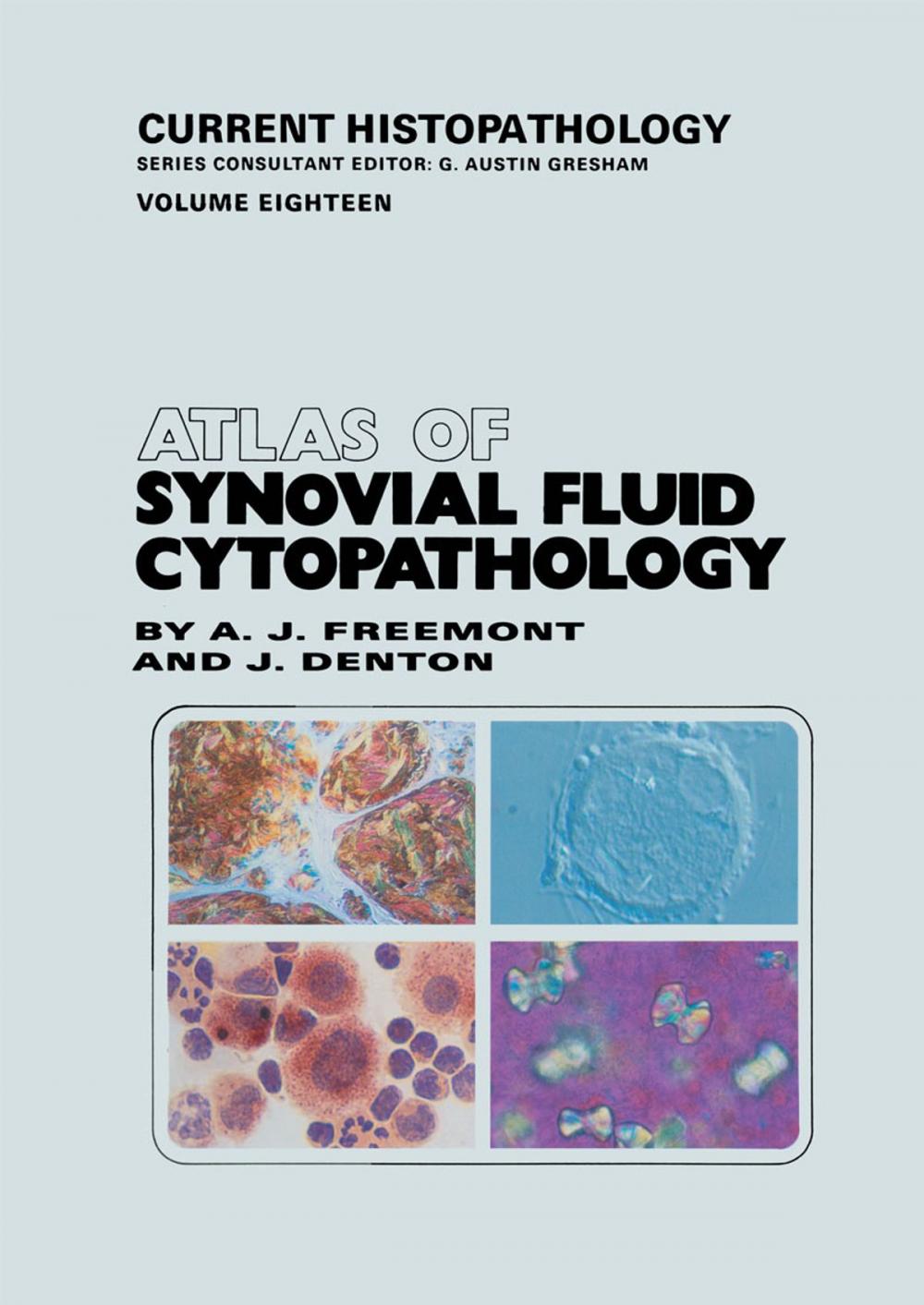 Big bigCover of Atlas of Synovial Fluid Cytopathology