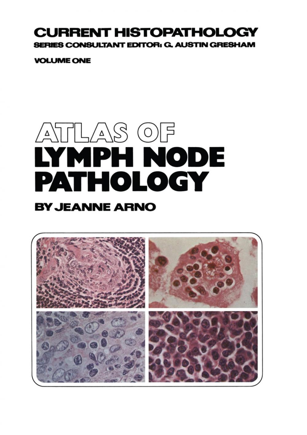 Big bigCover of Atlas of Lymph Node Pathology