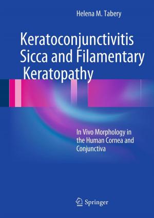 Cover of the book Keratoconjunctivitis Sicca and Filamentary Keratopathy by Michael Uebele, Thomas Wolf