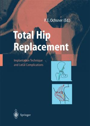 Cover of the book Total Hip Replacement by Lebogang Mateane, Carl Chiarella, Willi Semmler, Chih-Ying Hsiao