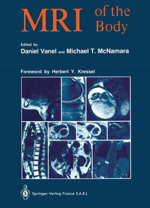 Cover of the book MRI of the Body by J.-E. Akerlund, B. Brismar, C.J. Cahill, M.R. Christiaens, W. Coosemans, S. Debus, W. Dietz, Rainer Engemann, J.A. Gruwez, T. Havia, J. Lerut, L. Lim, B. Lünstedt, W. Mokros, M. Philippe, G. Schindler, W. Schmitz, Arnulf Thiede, J. Verbruggen, L. Verougstraete, S. Vogel, I. de Wever