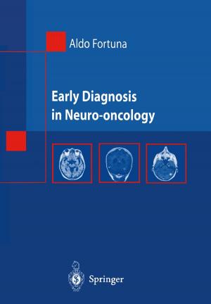Cover of the book Early Diagnosis in Neuro-oncology by D.R. Martin, L. Olivetti, A. Luca, M. Kirchin, A. Massmann, R. Seidel, L. Romanini, P. Fries, P. Caccia, M.P. Bondioni, K. Altmeyer, M. Harisinghani, R.V. D'Souza, D. Sahani