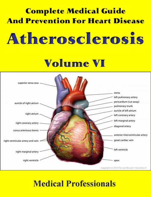 Cover of the book Complete Medical Guide and Prevention for Heart Diseases Volume VI; Atherosclerosis by Medical Professionals, MedHealth