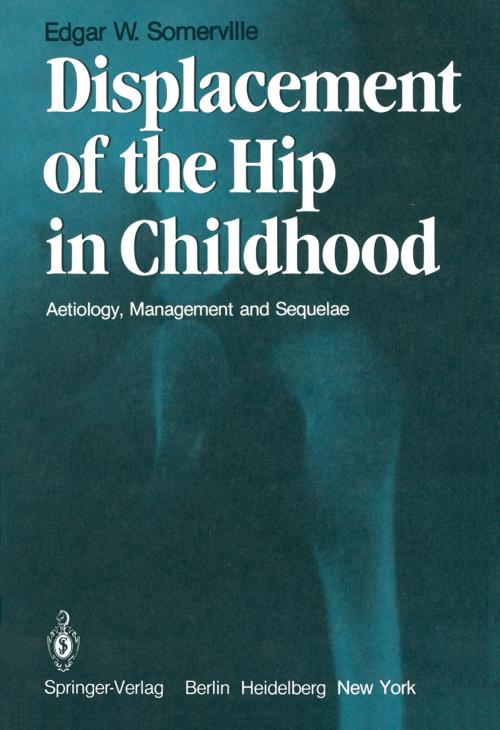 Cover of the book Displacement of the Hip in Childhood by E.W. Somerville, Springer London