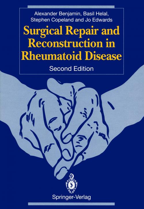 Cover of the book Surgical Repair and Reconstruction in Rheumatoid Disease by Alexander Benjamin, Basil Helal, Stephen A. Copeland, Jo C.W. Edwards, Springer London