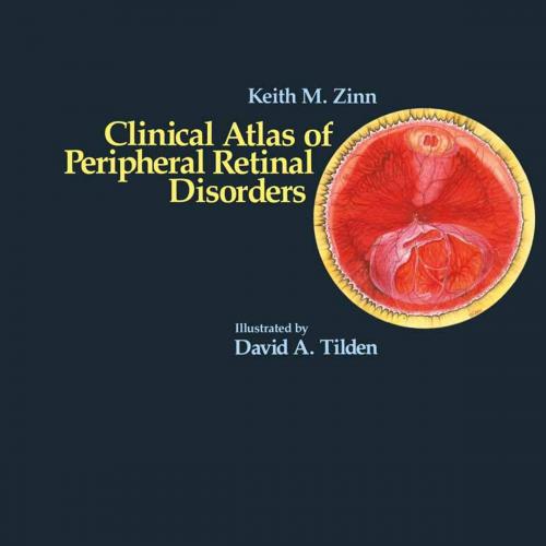 Cover of the book Clinical Atlas of Peripheral Retinal Disorders by Keith M. Zinn, Springer New York