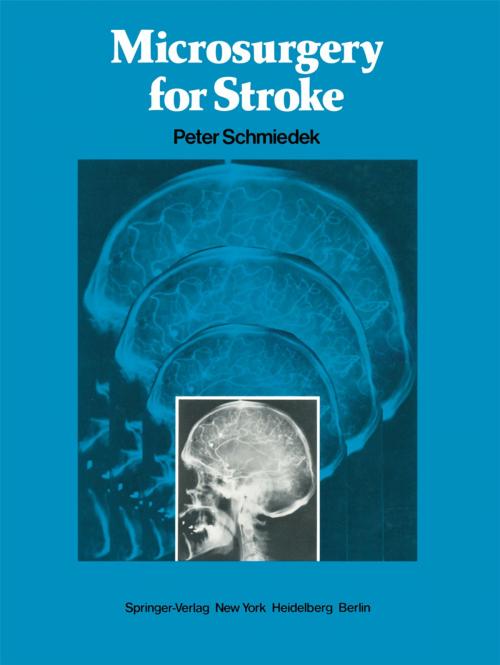 Cover of the book Microsurgery for Stroke by , Springer New York