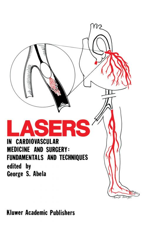 Cover of the book Lasers in Cardiovascular Medicine and Surgery: Fundamentals and Techniques by , Springer US