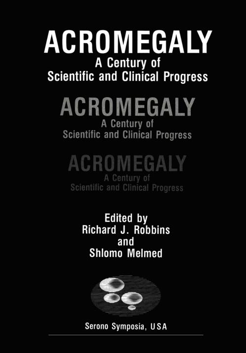 Cover of the book Acromegaly by Richard J. Robbins, Springer US