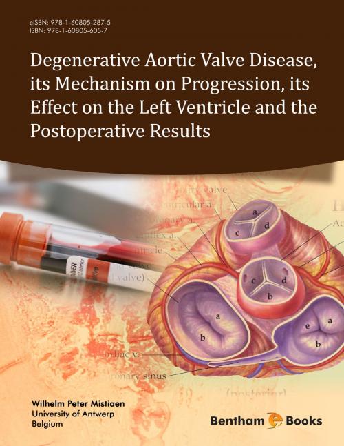 Cover of the book Degenerative Aortic Valve Disease, its Mechanism on Progression, its Effect on the Left Ventricle and the Postoperative Results by Wilhelm  Peter Mistiaen, Bentham Science Publishers