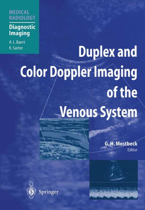 Cover of the book Duplex and Color Doppler Imaging of the Venous System by , Springer Berlin Heidelberg