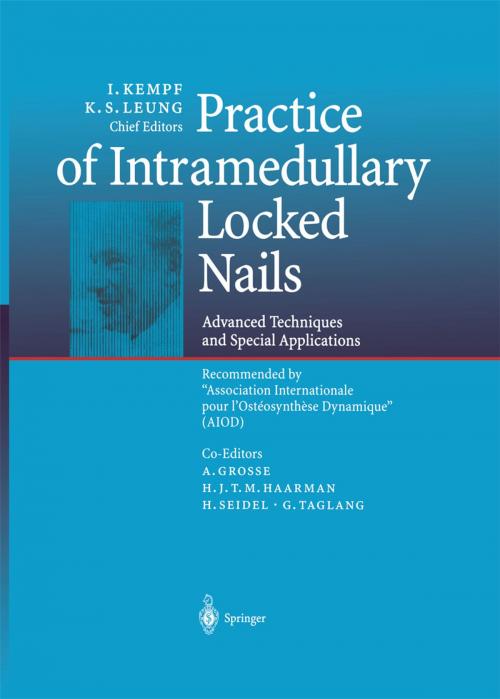 Cover of the book Practice of Intramedullary Locked Nails by A. Grosse, H.J.T.M. Haarman, H. Seidel, G.J.T.M. Taglang, Springer Berlin Heidelberg