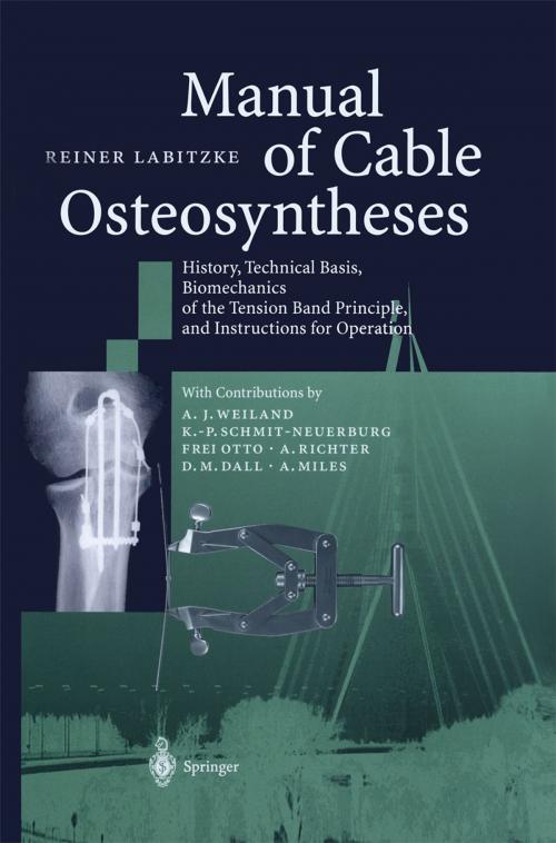Cover of the book Manual of Cable Osteosyntheses by A.J. Weiland, Reiner Labitzke, K.-P. Schmit-Neuerburg, F. Otto, A. Richter, D.M. Dall, A. Miles, Springer Berlin Heidelberg