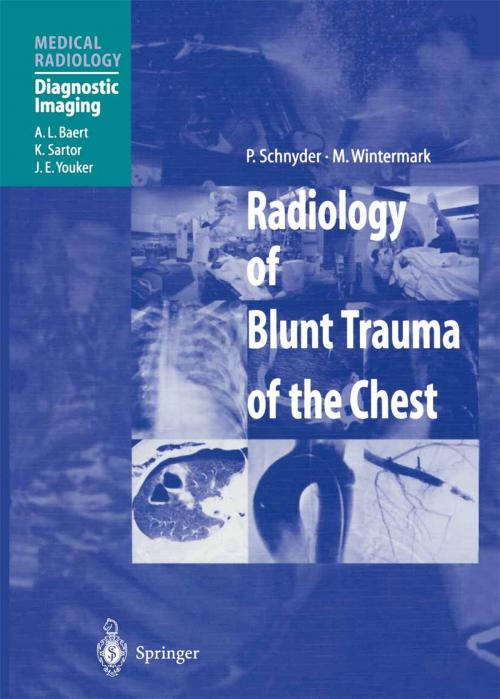 Cover of the book Radiology of Blunt Trauma of the Chest by G. Gamsu, P. Schnyder, M. Wintermark, Springer Berlin Heidelberg