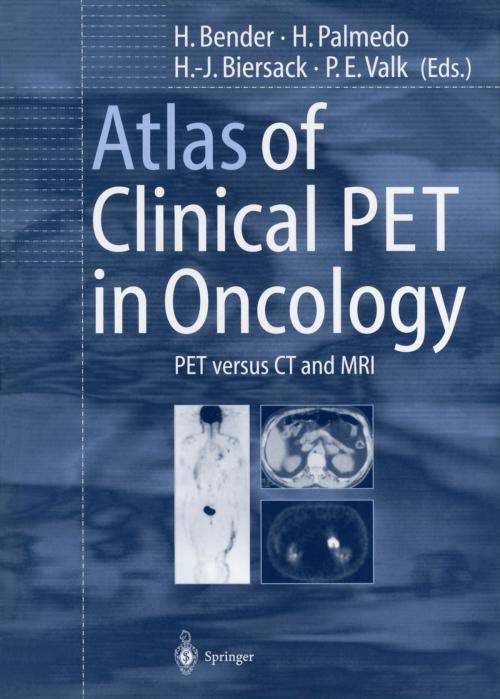 Cover of the book Atlas of Clinical PET in Oncology by , Springer Berlin Heidelberg