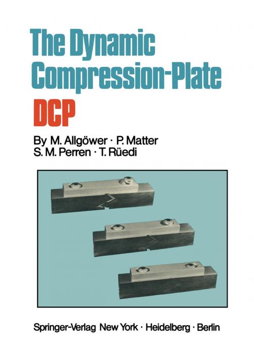 Cover of the book The Dynamic Compression Plate DCP by P. Matter, T. Rüedi, S.M. Perren, Martin Allgöwer, Springer Berlin Heidelberg