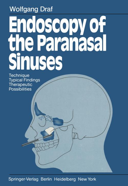 Cover of the book Endoscopy of the Paranasal Sinuses by Wolfgang Draf, Springer Berlin Heidelberg