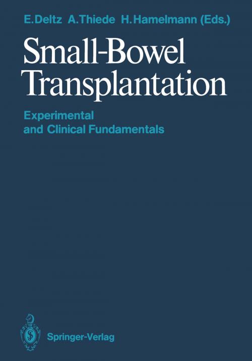 Cover of the book Small-Bowel Transplantation by , Springer Berlin Heidelberg