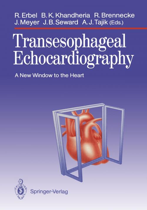 Cover of the book Transesophageal Echocardiography by , Springer Berlin Heidelberg