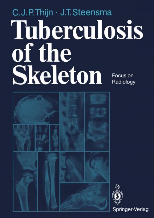 Cover of the book Tuberculosis of the Skeleton by Cornelis J.P. Thijn, Jieldouw T. Steensma, Springer Berlin Heidelberg