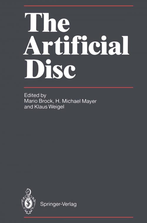 Cover of the book The Artificial Disc by , Springer Berlin Heidelberg