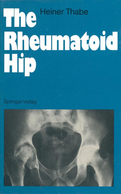 Cover of the book The Rheumatoid Hip by Heiner Thabe, Springer Berlin Heidelberg