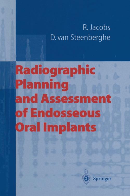 Cover of the book Radiographic Planning and Assessment of Endosseous Oral Implants by Reinhilde Jacobs, Daniel van Steenberghe, Springer Berlin Heidelberg