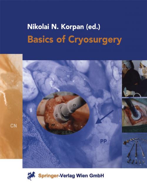 Cover of the book Basics of Cryosurgery by , Springer Vienna