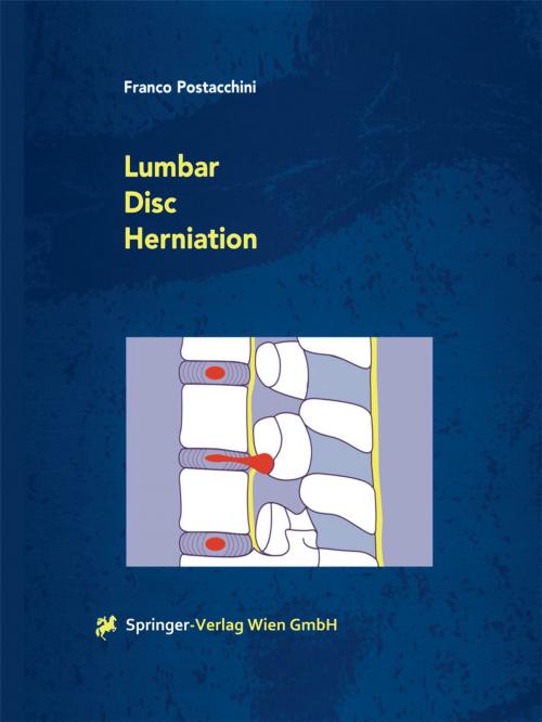 Cover of the book Lumbar Disc Herniation by Franco Postacchini, Springer Vienna