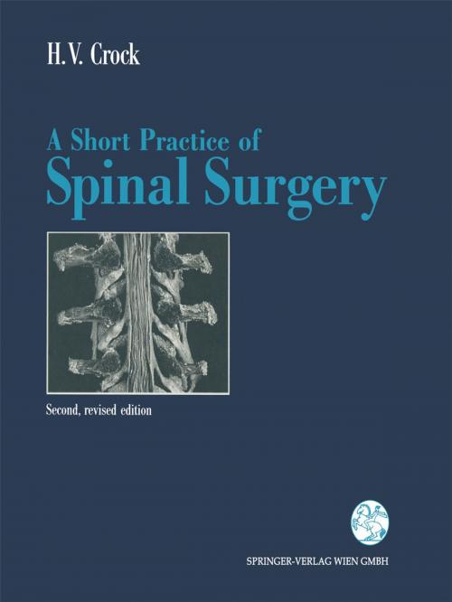 Cover of the book A Short Practice of Spinal Surgery by B.P. Galbally, Henry V. Crock, Springer Vienna