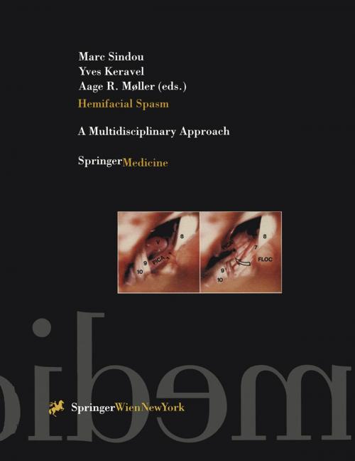 Cover of the book Hemifacial Spasm by , Springer Vienna