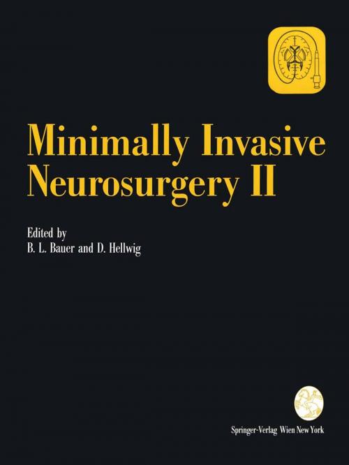 Cover of the book Minimally Invasive Neurosurgery II by , Springer Vienna