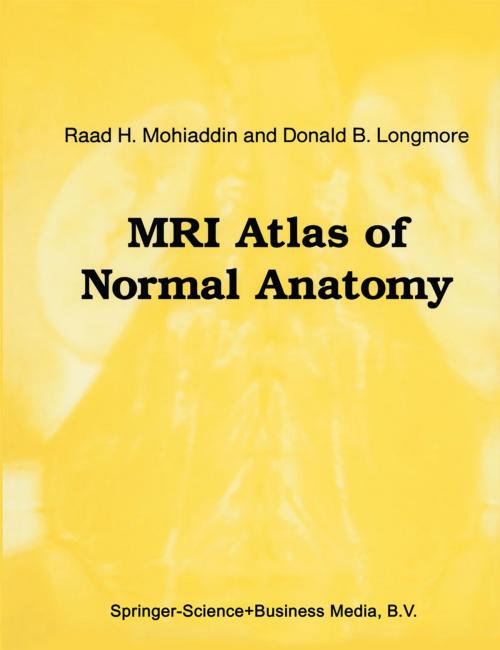 Cover of the book MRI Atlas of Normal Anatomy by Raad H. Mohiaddin, D.B. Longmore, Springer Netherlands