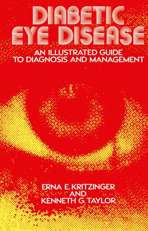 Cover of the book Diabetic Eye Disease by E.E. Kritzinger, K.G. Taylor, Springer Netherlands