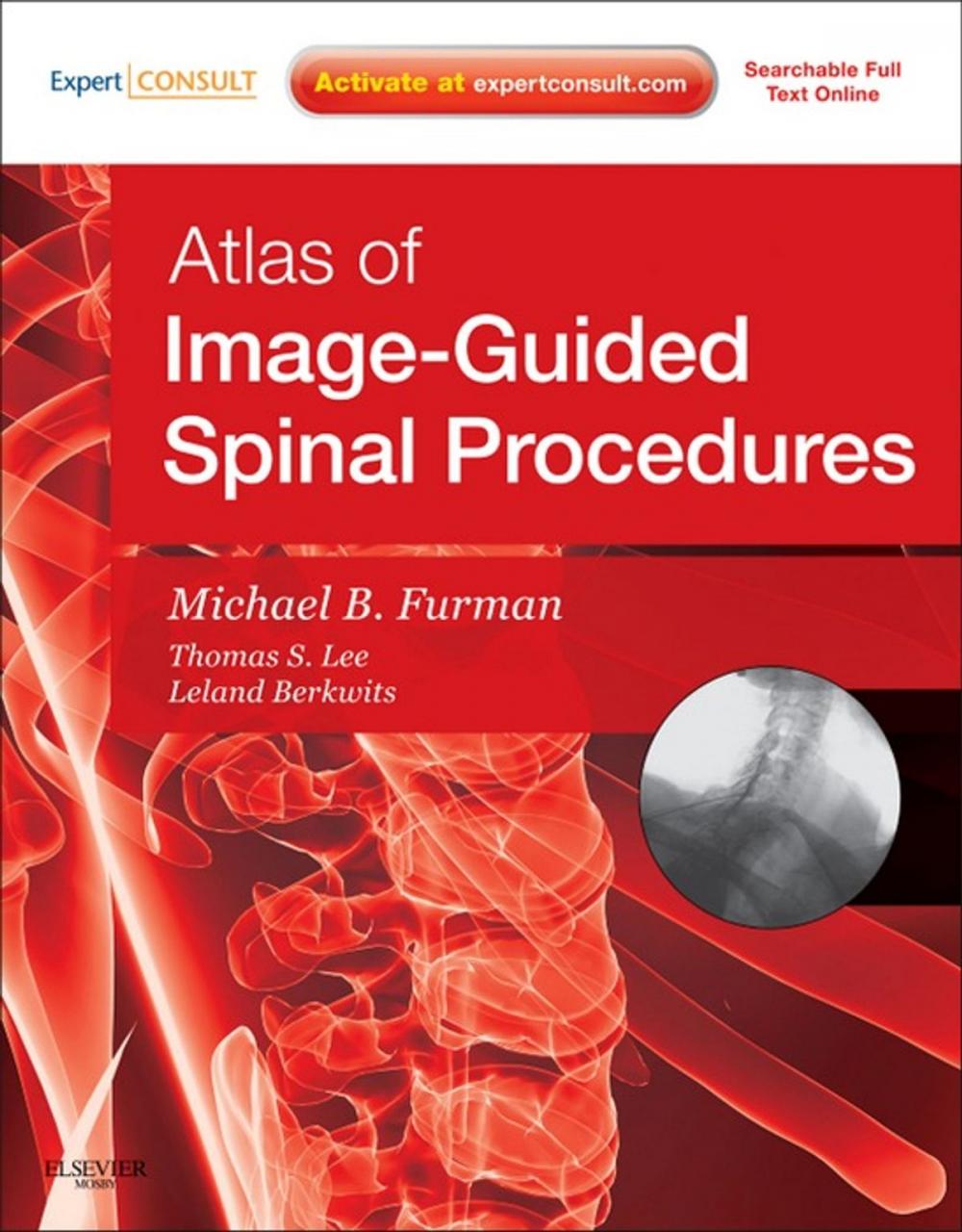 Big bigCover of Atlas of Image-Guided Spinal Procedures