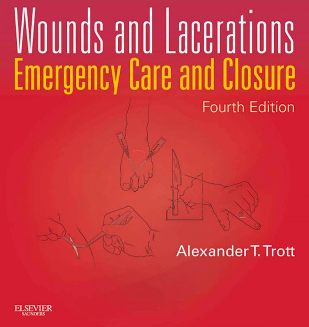 Big bigCover of Wounds and Lacerations - E-Book