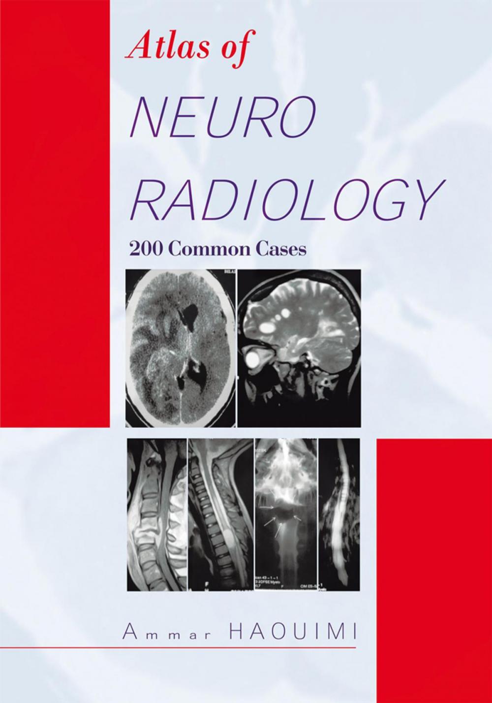 Big bigCover of Atlas of Neuroradiology