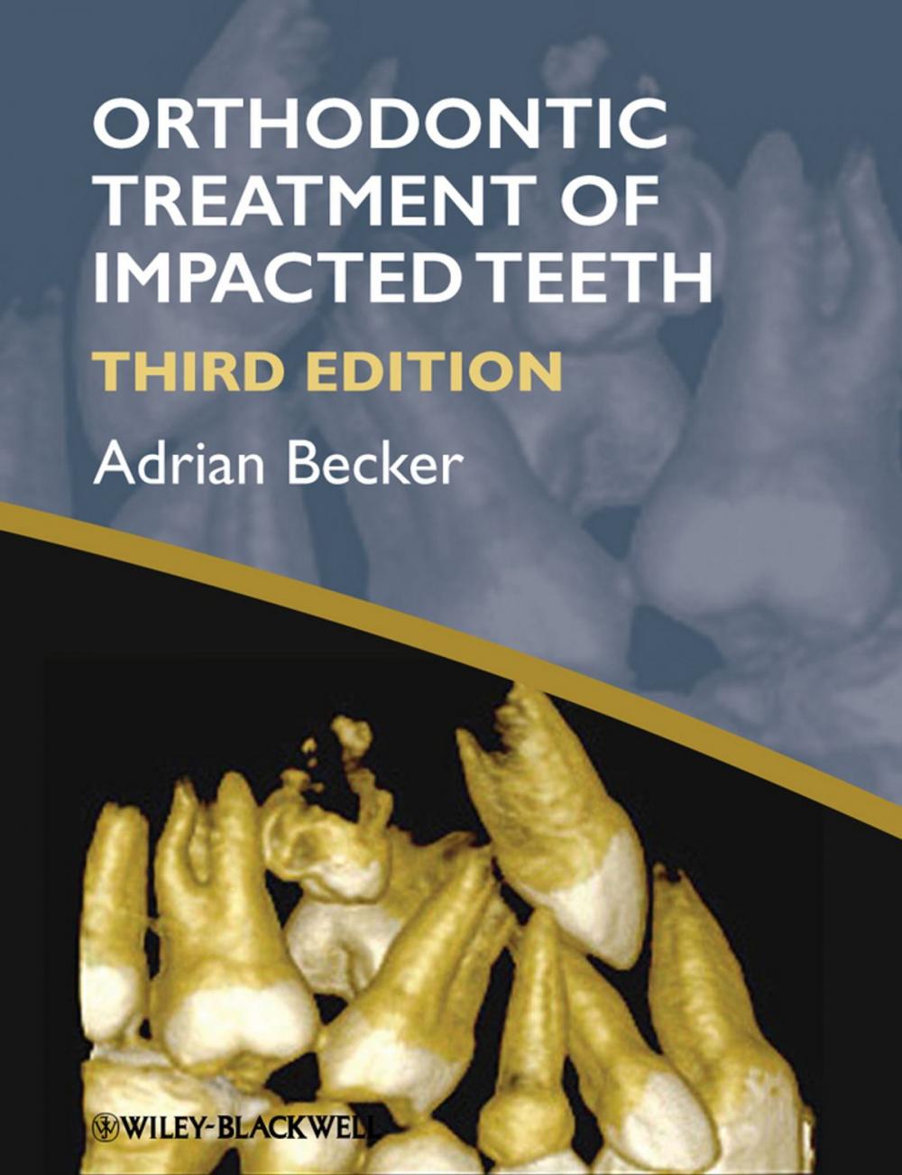 Big bigCover of Orthodontic Treatment of Impacted Teeth