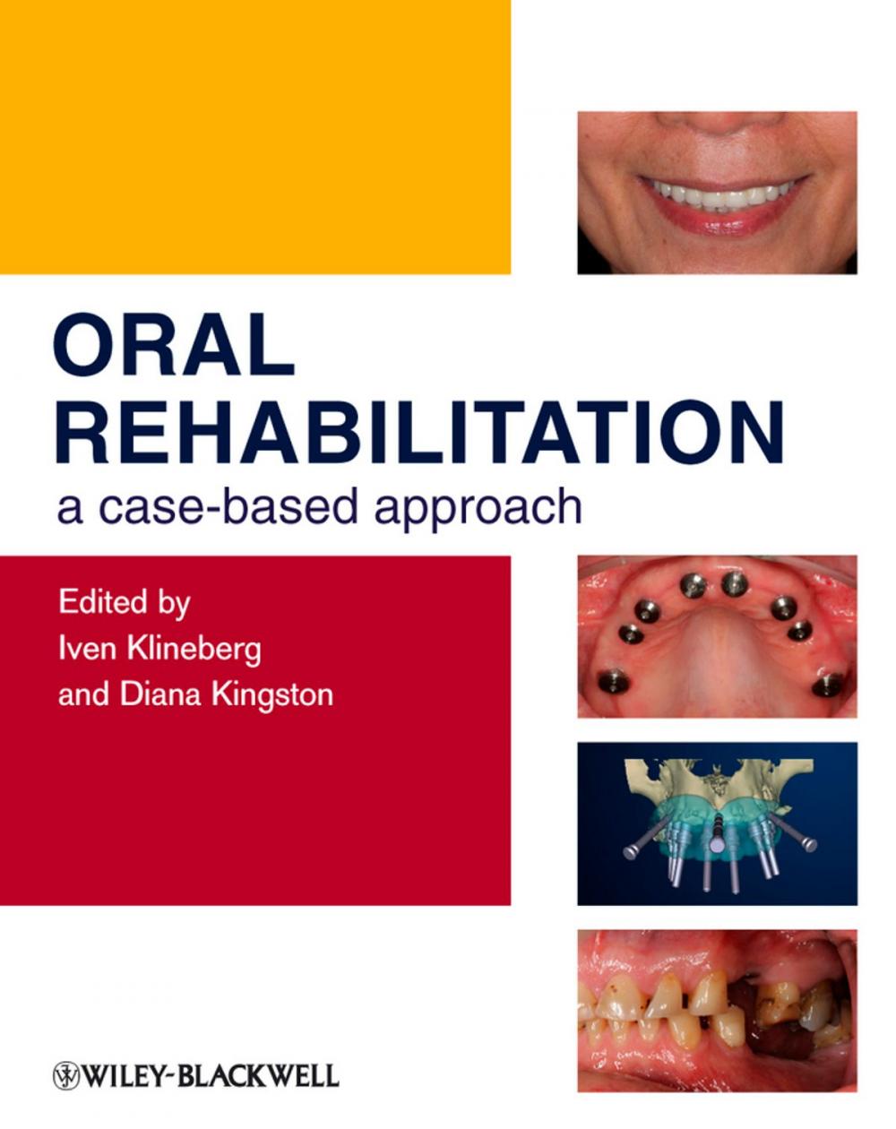 Big bigCover of Oral Rehabilitation