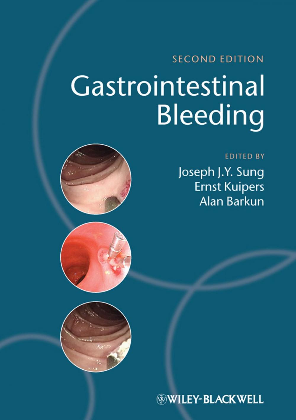 Big bigCover of Gastrointestinal Bleeding