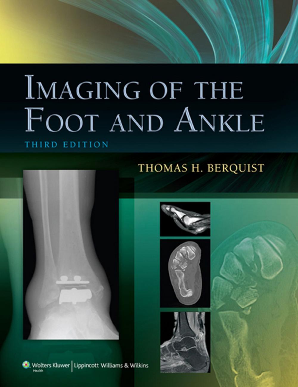 Big bigCover of Imaging of the Foot and Ankle