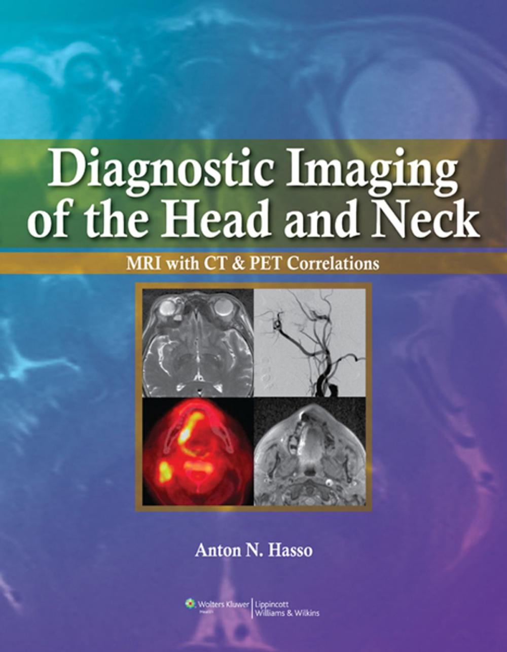 Big bigCover of Diagnostic Imaging of the Head and Neck