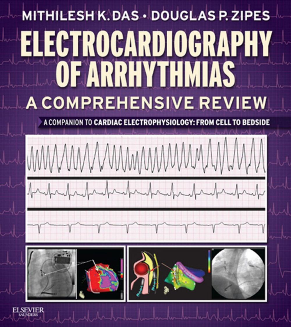 Big bigCover of Electrocardiography of Arrhythmias: A Comprehensive Review E-Book