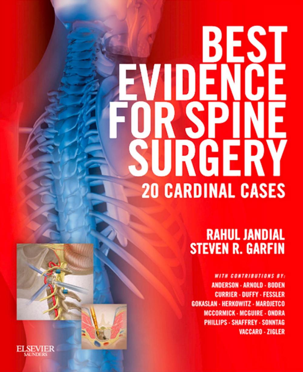 Big bigCover of Best Evidence for Spine Surgery E-Book